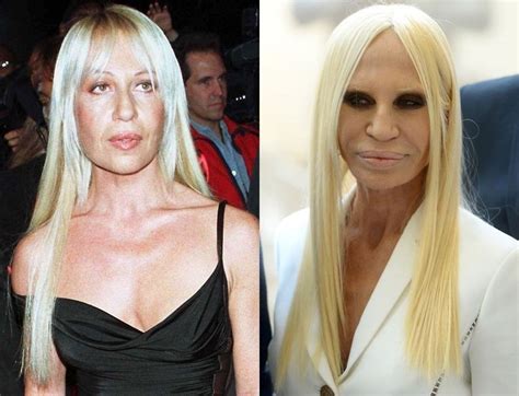 donatella versace piccola|donatella versace before and after surgery.